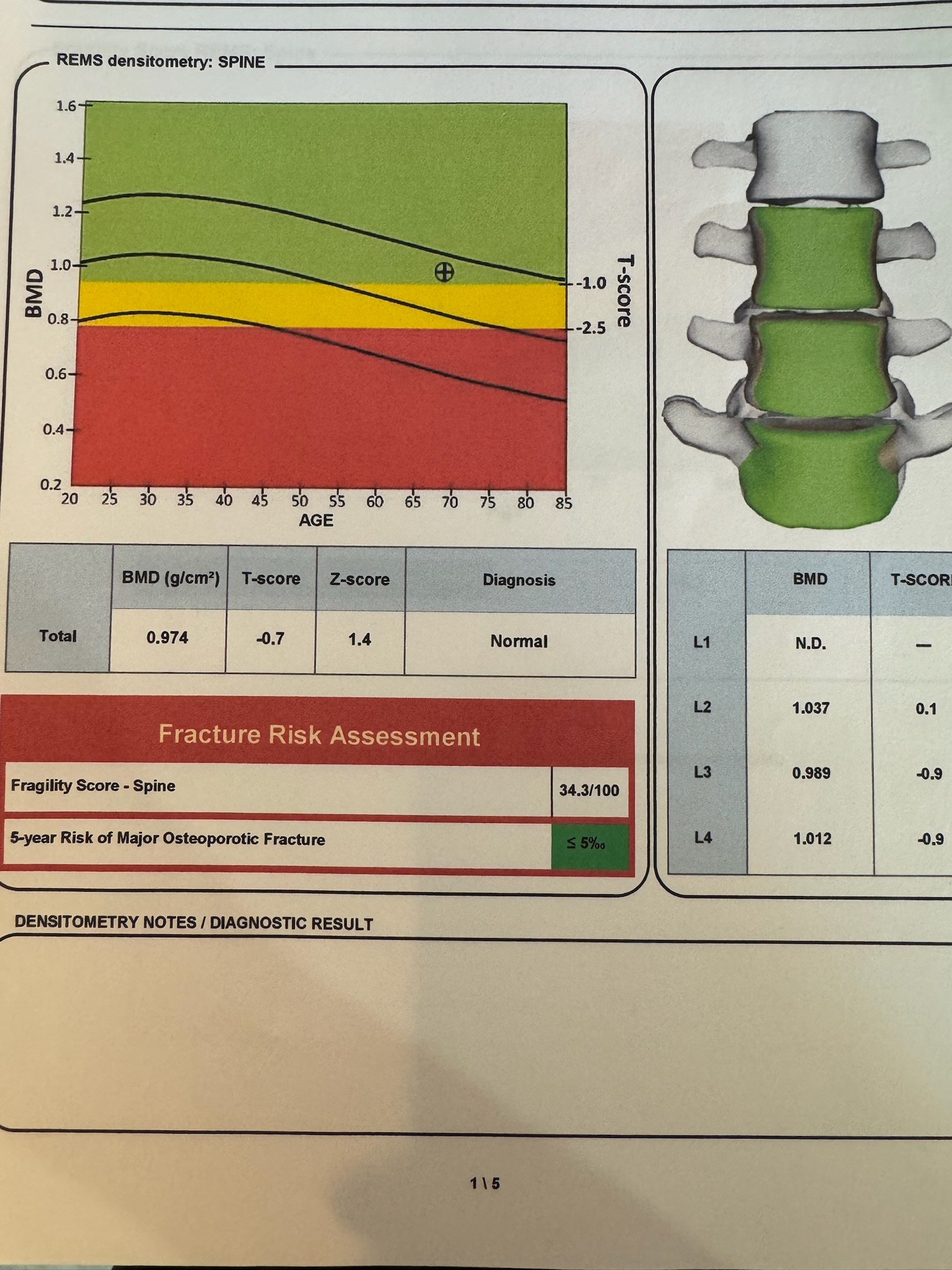 Color-coded REMS bone densitometry report showing a bone density graph, vertebra diagram, and fracture risk assessment table.