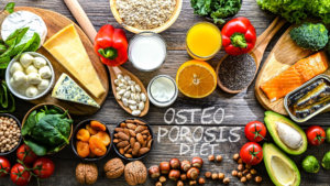 Osteoporosis Diet: Colorful spread of calcium & vitamin-rich foods: dairy, salmon, greens, nuts, citrus.